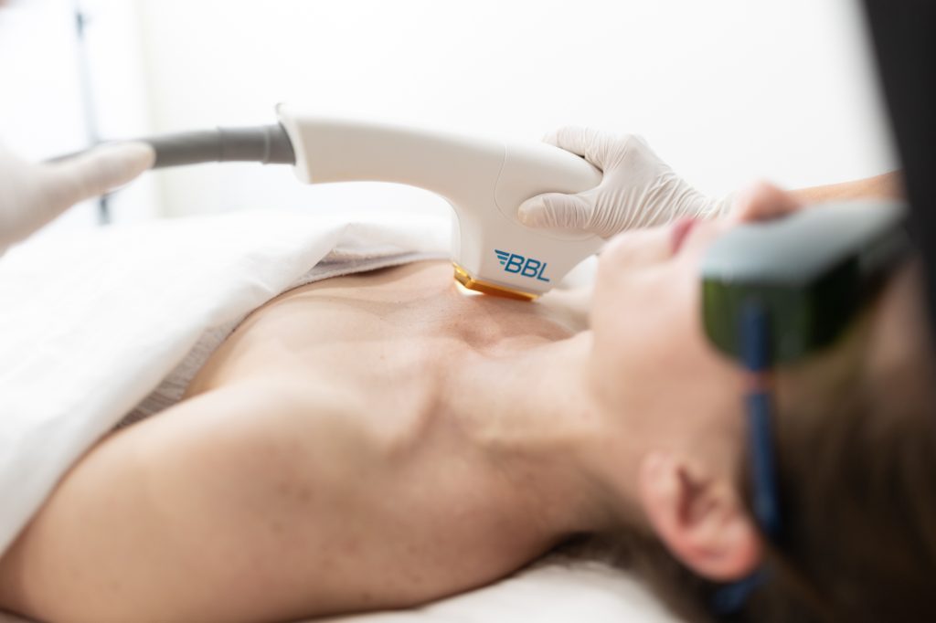 BBL-Photofacial-West-Bloomfield-Township-MI